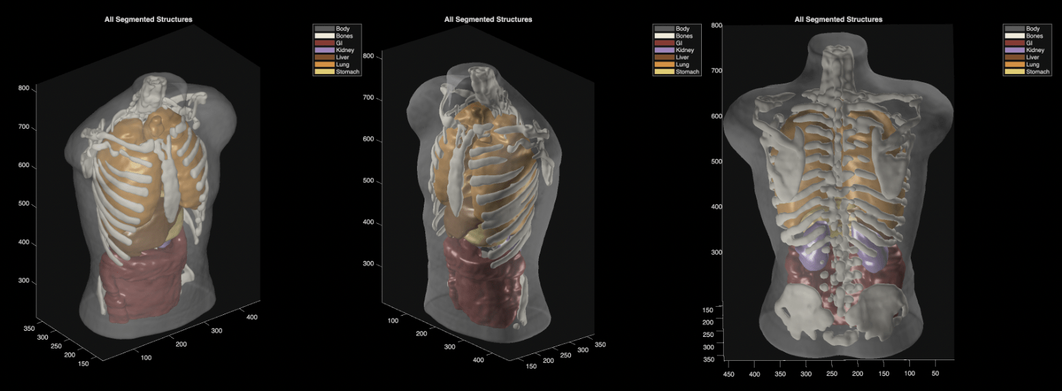 Midjourney's Medical Leap
