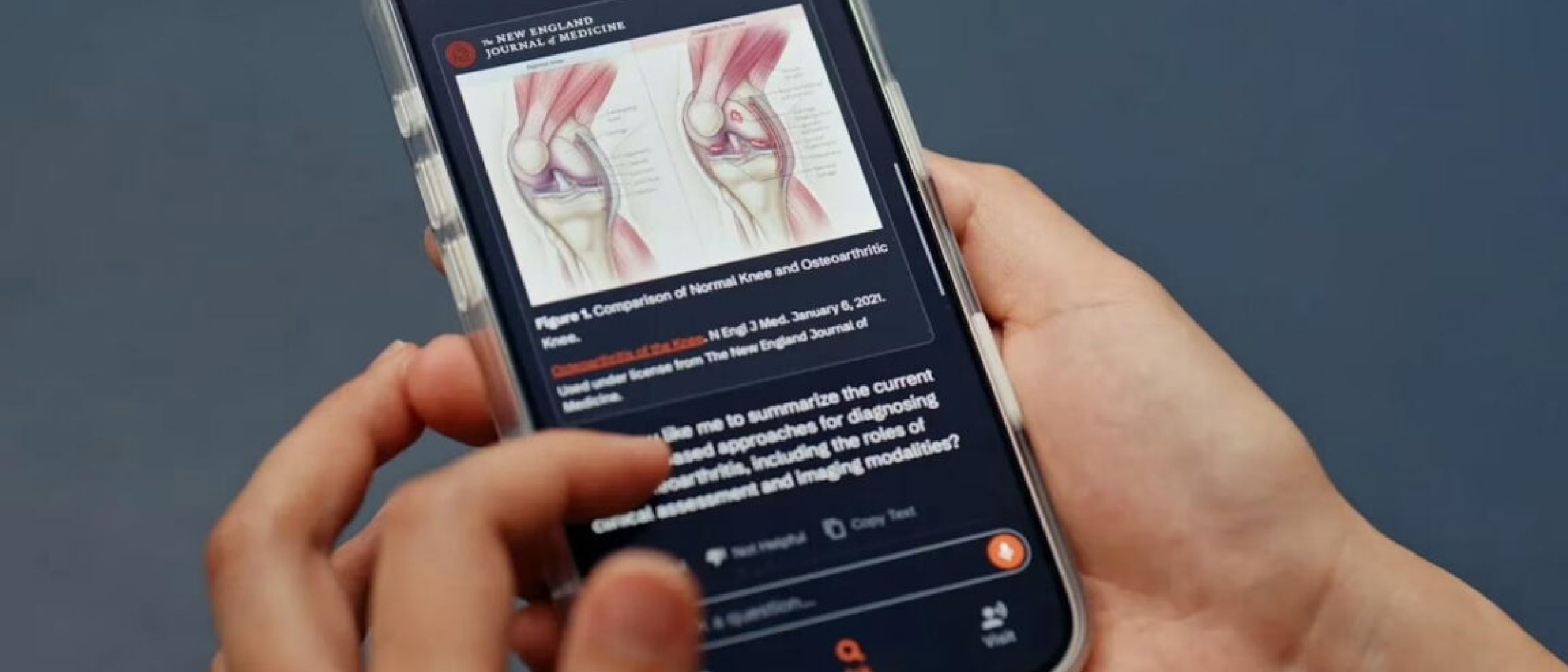 Open Evidence: $15B AI Search Revolutionizing Doctors